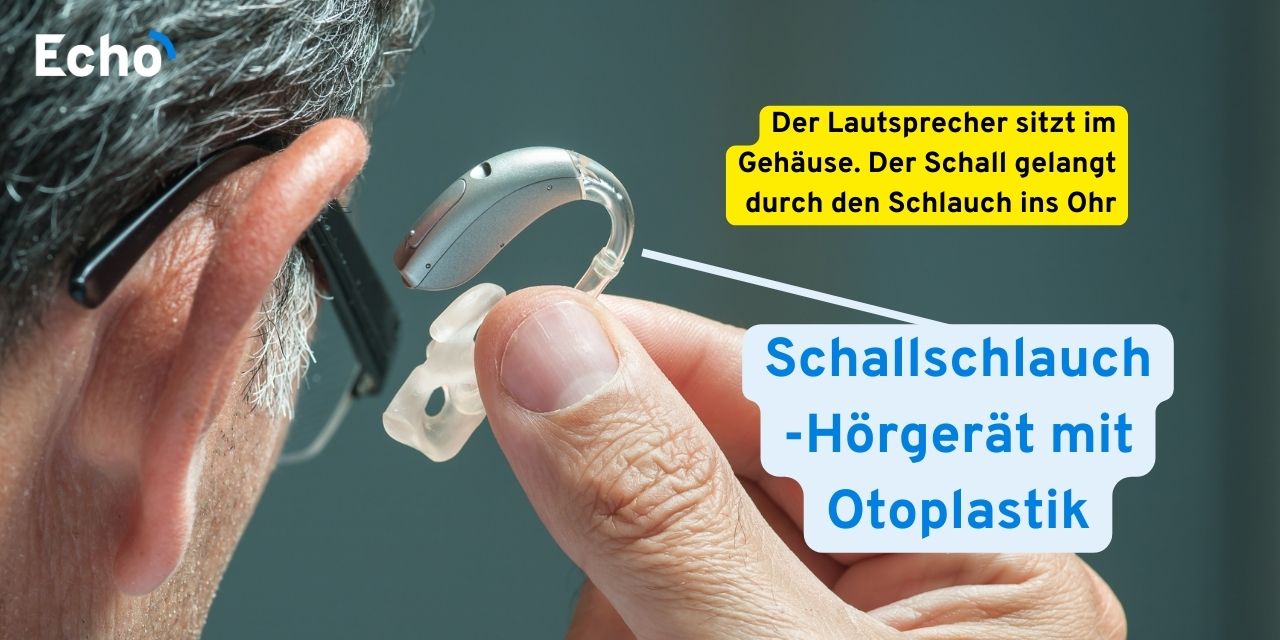 So funktioniert ein Hörgerät • einfach erklärt [mit Aufbau] Echo