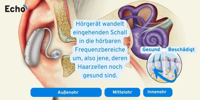 Wie funktioniert das Ohr? » Hörprozess in 4 Stufen erklärt - Echo
