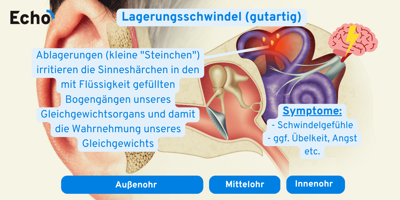 knacken im ohr beim gähnen