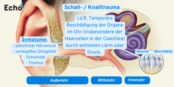 Rauschen Im Ohr Bei Erkältung 13 häufigste Ohrenerkrankungen👂🏼 [Ursachen, Symptome & Tipps] - Echo