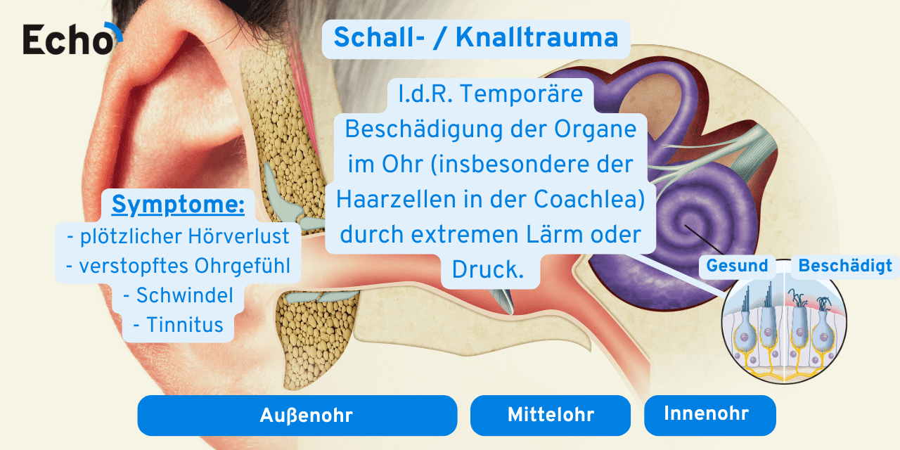 Was Passiert Wenn Man Den Verstoß Nicht Zugibt 13 häufigste Ohrenerkrankungen👂🏼 [Ursachen, Symptome & Tipps] - Echo