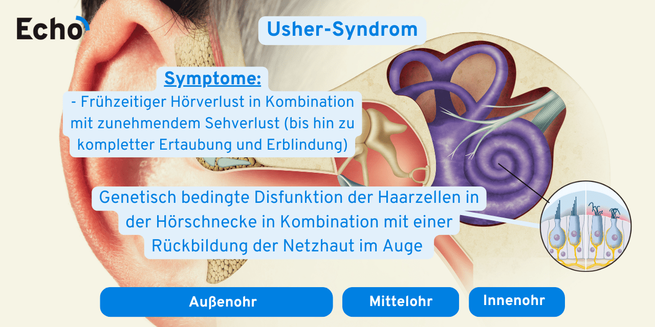 Symptome Einer Mittelohrentzündung Bei Erwachsenen 13 häufigste Ohrenerkrankungen👂🏼 [Ursachen, Symptome & Tipps] - Echo